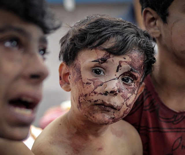 A little boy in a Gaza hospital as he and his brother survived the Israeli shelling of three houses in the enclave on 23 October by Belal Khaled
