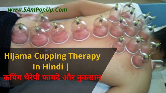 Hijama Cupping Therapy In Hindi | कपिंग थैरेपी फायदे और ऩुकसान