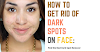 How to Get Rid of Dark Spots on the Face