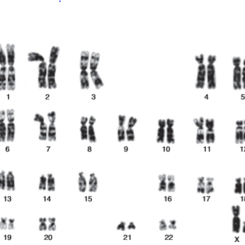 Human chromosomes - Differences In Male And Female Chromosomes  