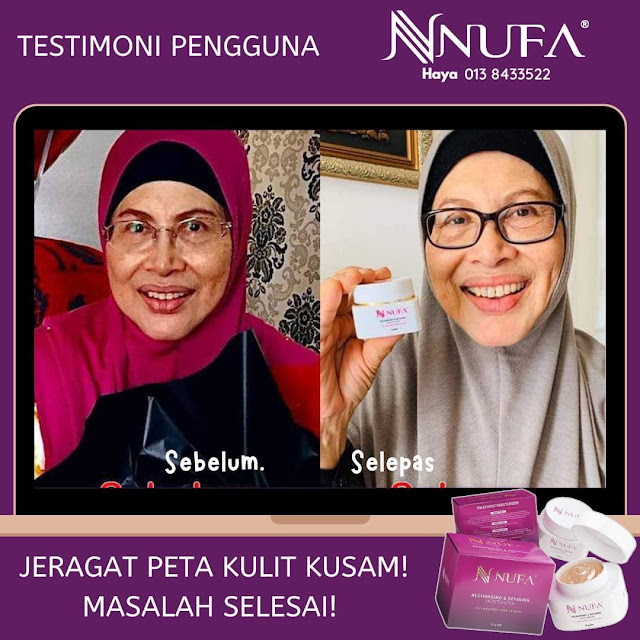 TESTIMONI NUFA TREATMENT MOISTURIZER