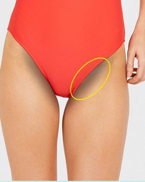 How To Lighten Dark Inner Thighs, Butt And Bikini Area