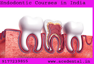 Rotary Endodontics Course, Endodontics Course India, Endodontic Courses in India, Endodontic Certificate Course