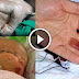 9 Unbelievable Miracle Babies In The World, You Are Astonished!