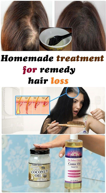 Homeopathy Treatment to Control Hair Fall