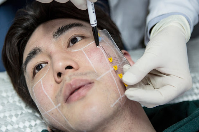 عمليات زرع الوجه، ومحاولات تحسين حياة المرضى