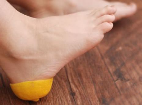 Topuk çatlaklarına limon çözümü