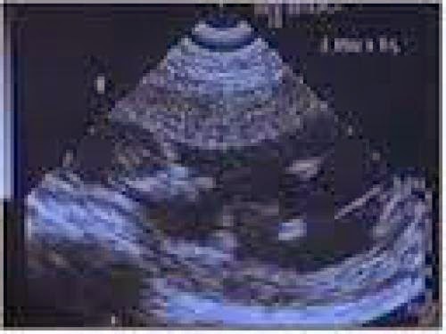 Do We Hear Their Cry Homily For Respect Life Sunday