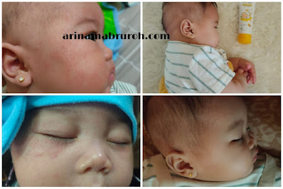 kulit wajah bayi sensitif kering dan memerah
