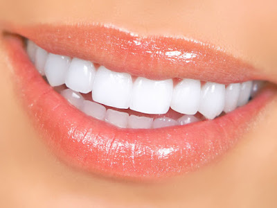 Trồng răng sứ nguyên hàm khi nào? 