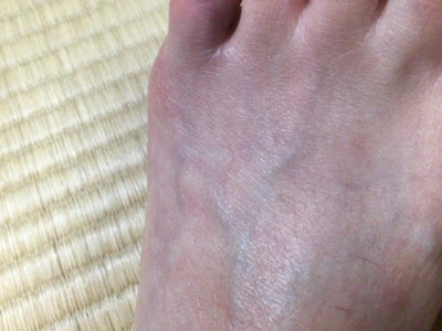 [最新] 足の小指 骨折 仕事 休めない 114043-足の小指 骨折 仕事 休めない
