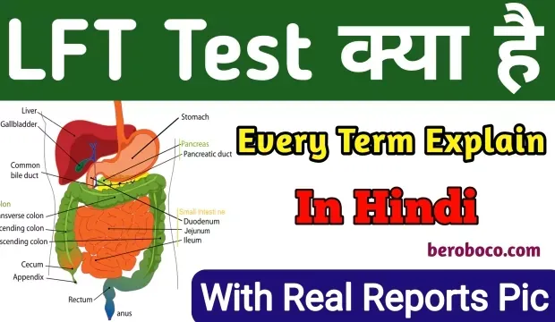 LFT Full Form | LFT Test In Hindi, LFT Test Kya Hai, LFT Test Means In Hindi, LFT Test Kya Hota Hai और LFT Test Kyu Kiya Jata Hai आदि के बारे में Search किया है और आपको निराशा हाथ लगी है ऐसे में आप बहुत सही जगह आ गए है, आइये LFT Test Kaise Hota Hai, LFT Me Kon Kon Se Test Aate H, LFT Test Full Form In Hindi और एलएफटी का फ़ुल फ़ॉर्म ​आदि के बारे में बुनियादी बाते जानते है।