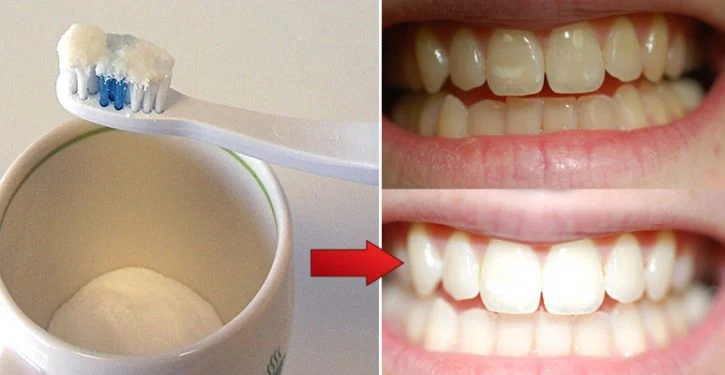 A Powerful Trick To Have White Teeth. Unbelievable !