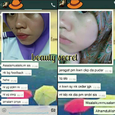 testimoni beauty secret shalicious