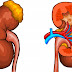 Kidney Cancer Symptoms - Causes of Kidney Cancer and More