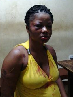 Pregnant lady battered by husband sends him a shocking birthday message