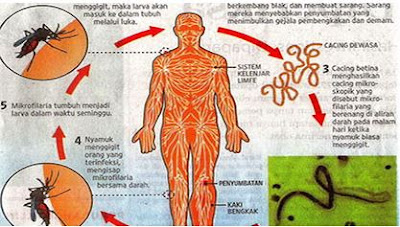 KONSELING,  PENYAKIT ,FILARIASIS, ( SOP ),AKREDITASI PUSKESMAS,AKRED,