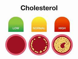 Cholesterol levels