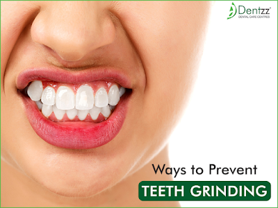 Ways to Prevent Teeth Grinding- Dentzz