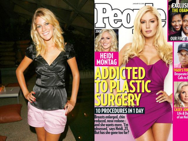 heidi montag before and after plastic. Heidi Montag Ashlee Simpson