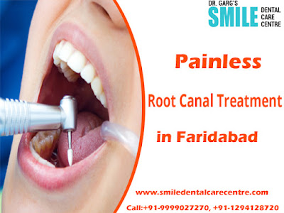 Painless Root Canal Treatment in Faridabad