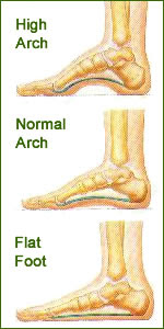 Foot Arches and their Height