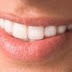 Teeth Whitening Tips- in schneller