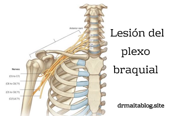 Lesión del plexo braquial: Anatomía, síntomas y tratamiento Lesión del plexo braquial: Anatomía, síntomas y tratamiento