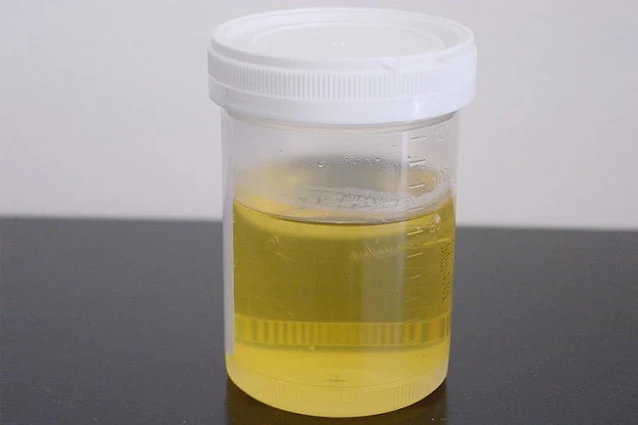 Urine mousseuse: Voici pourquoi vous avez des bulles dans votre urine