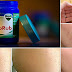 8 Surprising Uses of Vicks Vaporub