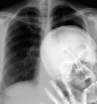 Selfie no raio X