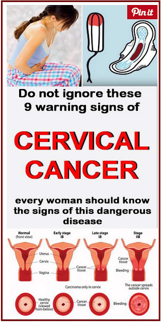 9 Warning Signs of Cervical Cancer You Shouldn't Ignore