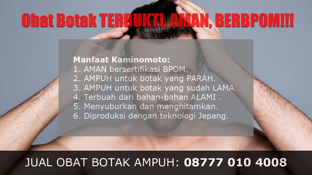 jual OBAT PENUMBUH RAMBUT BOTAK Magelang<br/>