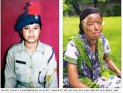 Mulher que teve rosto queimado com ácido ganha R$ 92 mil na Índia