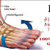 Stroke Rehab