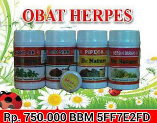 Obat Herpes Termanjur