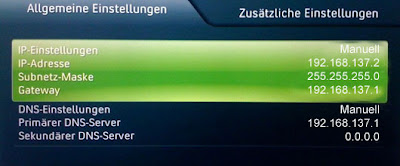 Netzwerkeinstellungen der Xbox 360