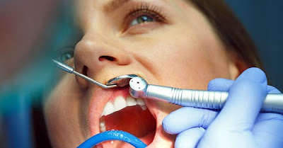 Chảy máu chân răng sau khi lấy cao răng không đáng lo ngại 2
