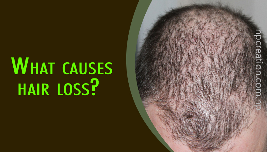 What causes hair loss? Let's know