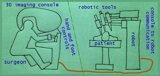 Sketch of 3D robotic surgery step