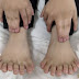 Boy With Record 31 Fingers And Toes