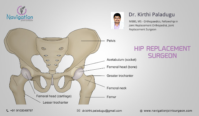 Best Hip Replacement Surgeon in Hyderabad