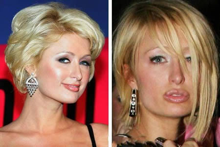 12 Weirdiest Plastic Surgery Makeovers