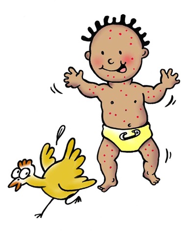 Chicken Pox Baby Cartoon