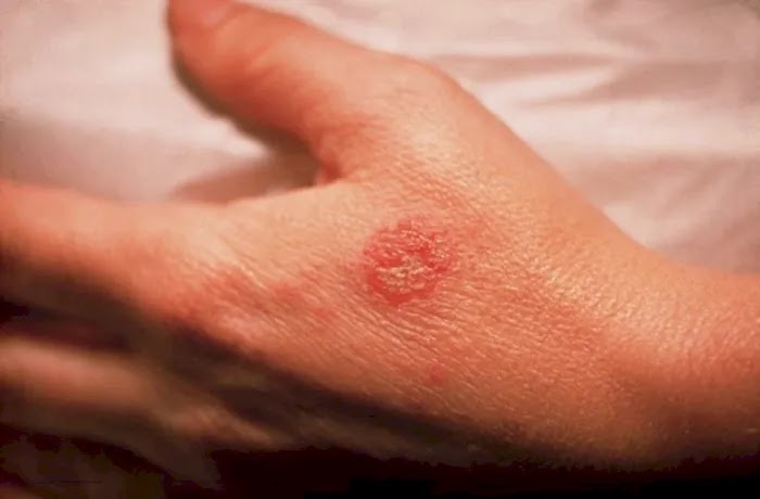 Causes of Dry Skin