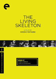 Living Skeleton cover and link to box set on Amazon