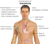 obat penyakit insomnia alami