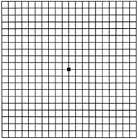 Amsler Grid