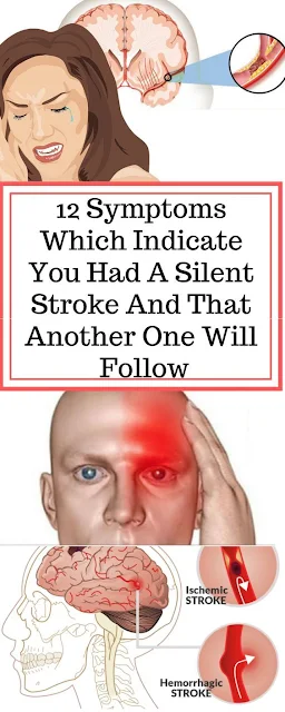 12 Symptoms Which Indicate You Had A Silent Stroke And That Another One Will Follow
