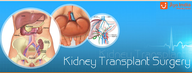 best kidney transplant specialist in India